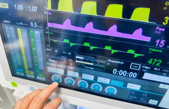 Understanding Airway Occlusion Pressure: A Guide to Breathing Effort Assessment Image